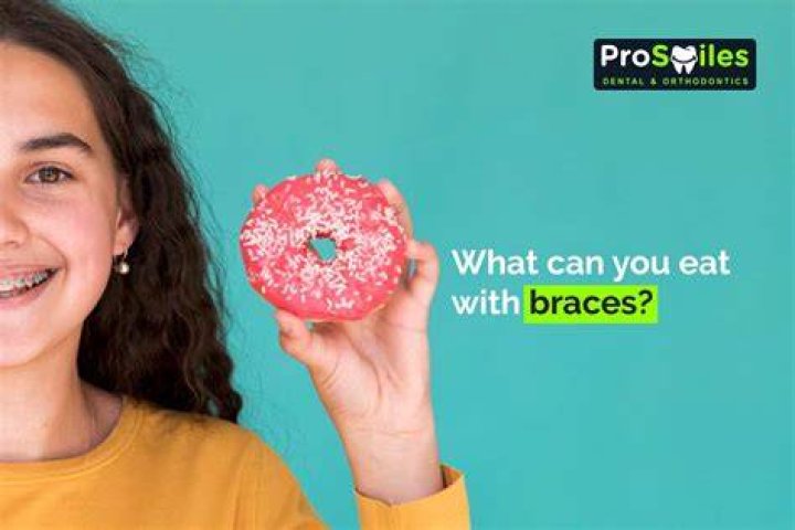 Can You Eat Cupcakes With Braces