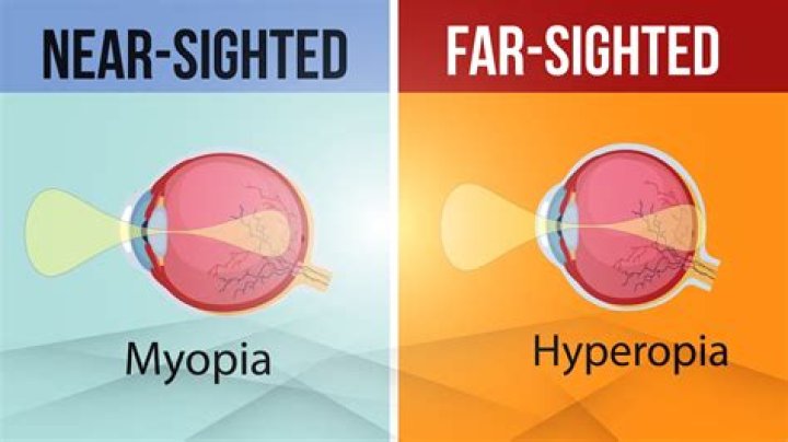 Difference Between Farsighted And Nearsighted