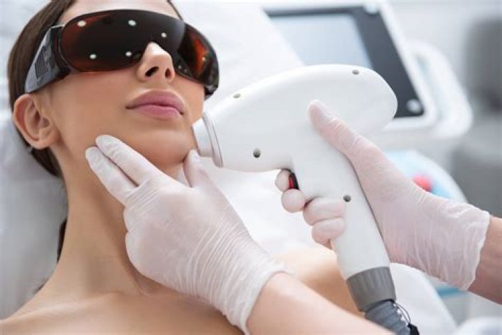 Female laser hair removal face