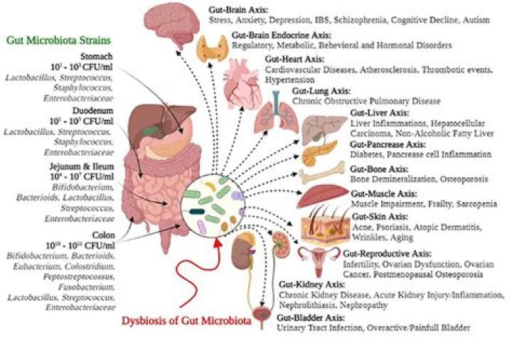 Gut spread - How To Discuss