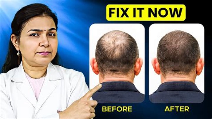 Hair thinning treatment female - How To Discuss