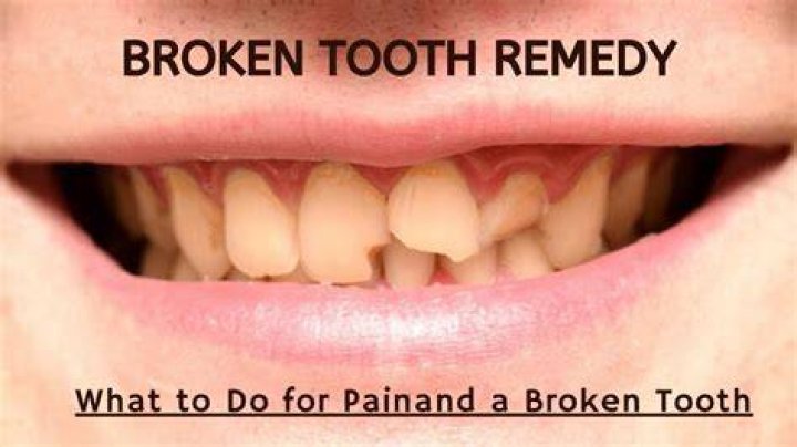 How To Use Dentemp On Broken Tooth