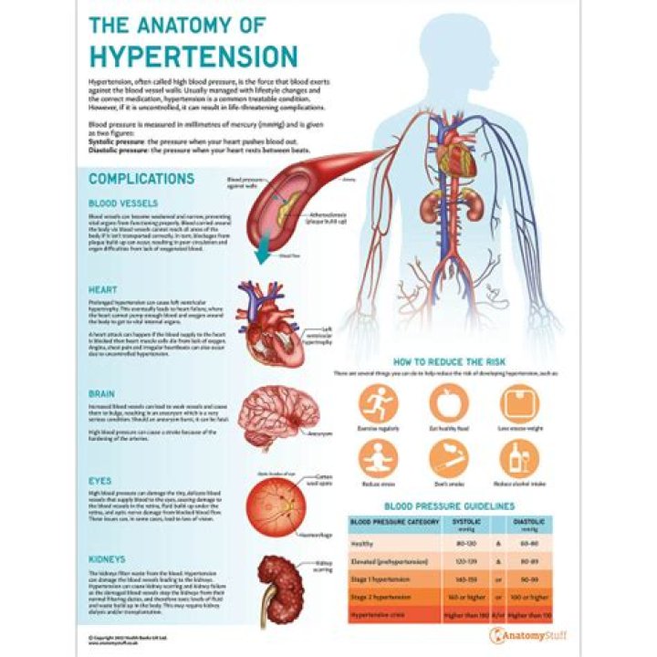 Hypertension in Men - How To Discuss