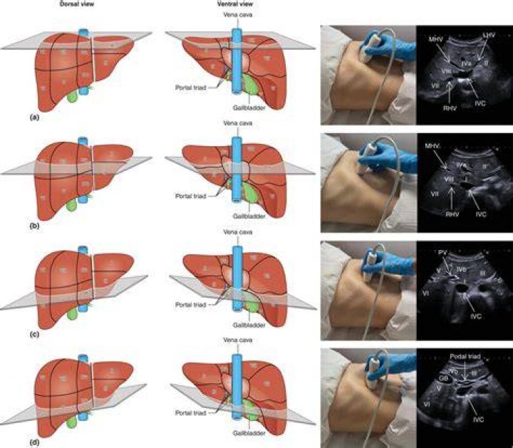 Lamb liver - How To Discuss