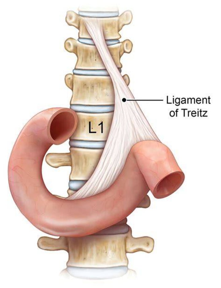 Ligament Of Treitz - How To Discuss