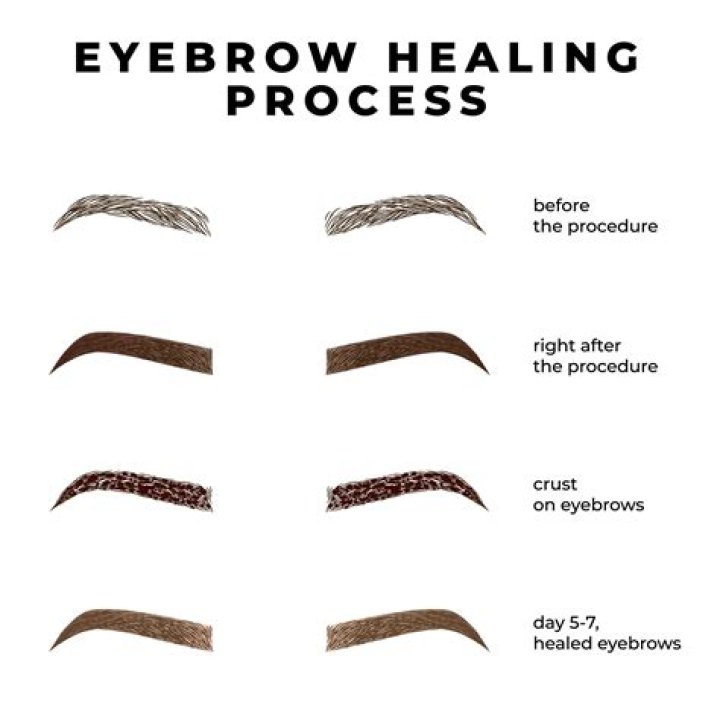 Micro eyebrows - How To Discuss