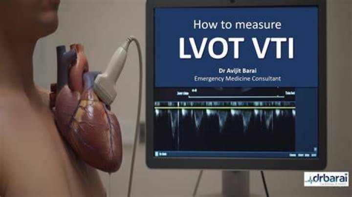 Nysearca vti - How To Discuss