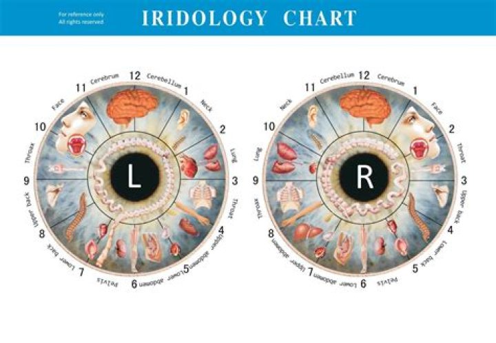Operating Ratio (IRIS) - How To Discuss