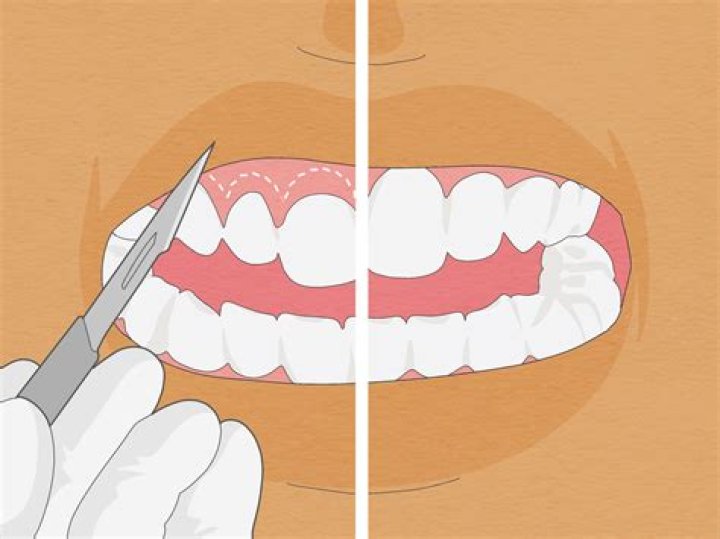 Push Teeth Back With Fingers