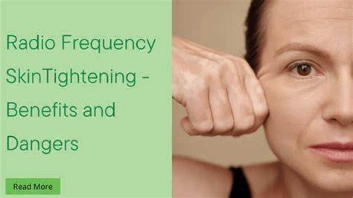 Radio frequency skin tightening dangers