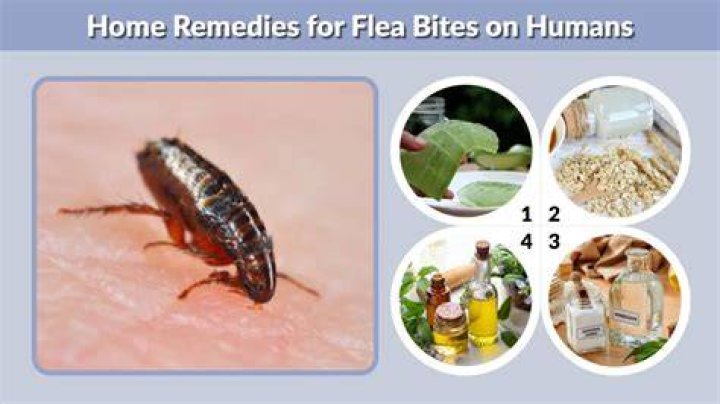 Relief For Flea Bites On Humans