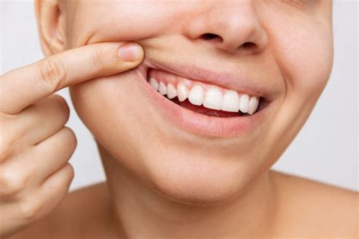 Sorridents PreÃ§os - How To Discuss