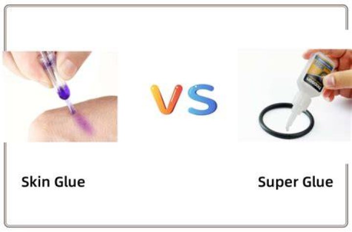 Super Glue On Skin While Pregnant