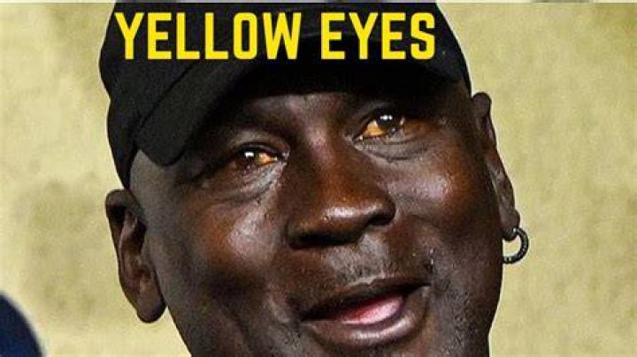 Why Michael Jordan's Eyes are Yellow?